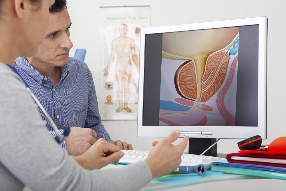 Female Doctor showing to a pacient a Prostate gland Illustration